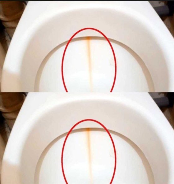 I apply it to the toilet brush and clean the toilet. The limescale disappears in the blink of an eye!!