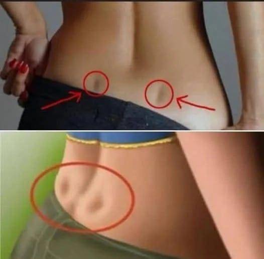 If You Have These Two Holes in Your Back, It Means You Don’t… Need to Worry! (The Truth About “Venus Dimples”)