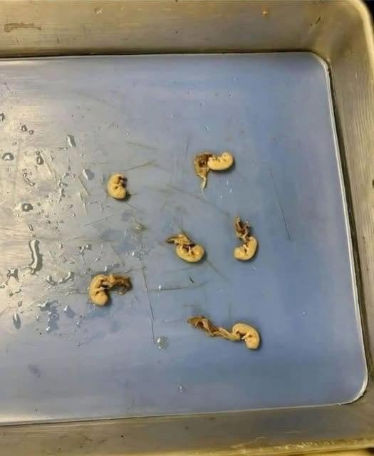 Beware the “Seeds in Your Snack”: How Hidden Threats Can Lurk in Everyday Foods