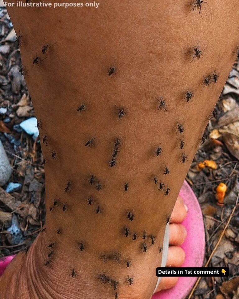 Why Do Mosquitoes Always Seem to Target You? The Science Behind It