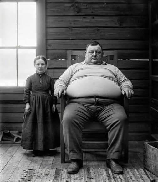 She was 1.2 m tall, he weighed 227 kg: their 12 deformed children shocked science (1897)