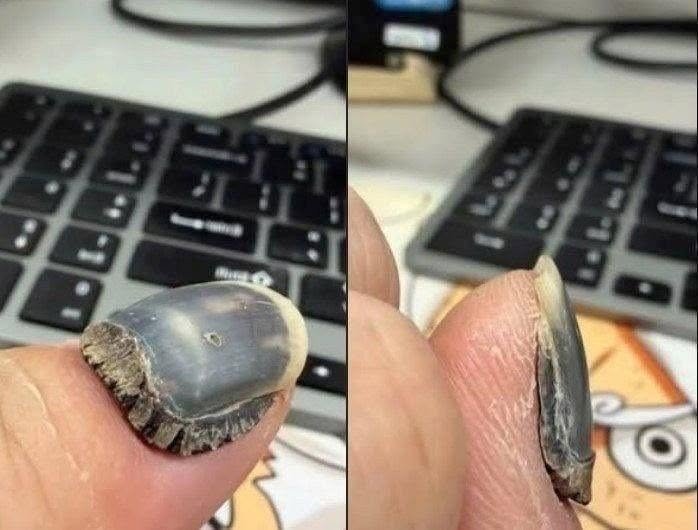 These are the consequences of using too much