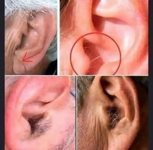 Why Hair Grows on Your Ears as You Age: The Science Behind This Common Change