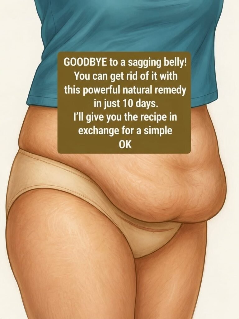 The Cesarean Section Flap: Why That “Bag” of Skin Remains