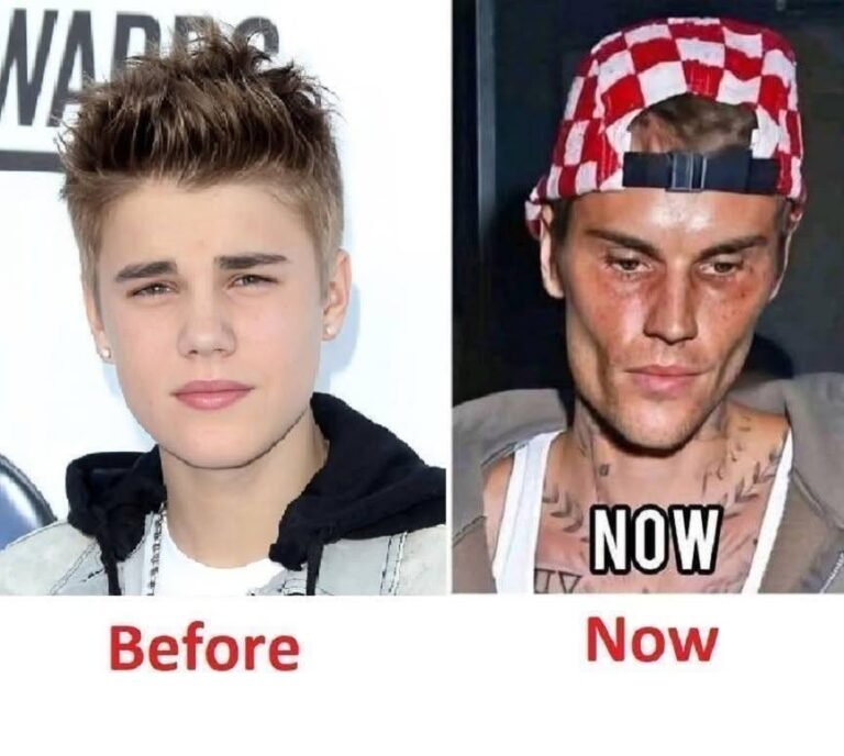 🥺Justin Bieber admits that he tested positive for…See More