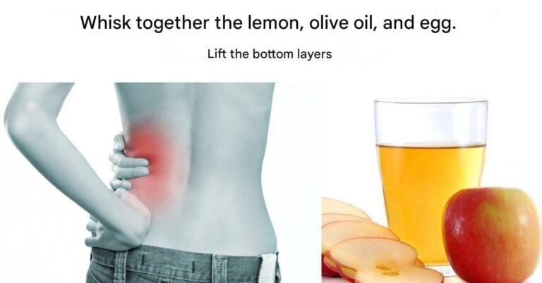 Mix lemon, olive oil, and vinegar to dissolve kidney stones