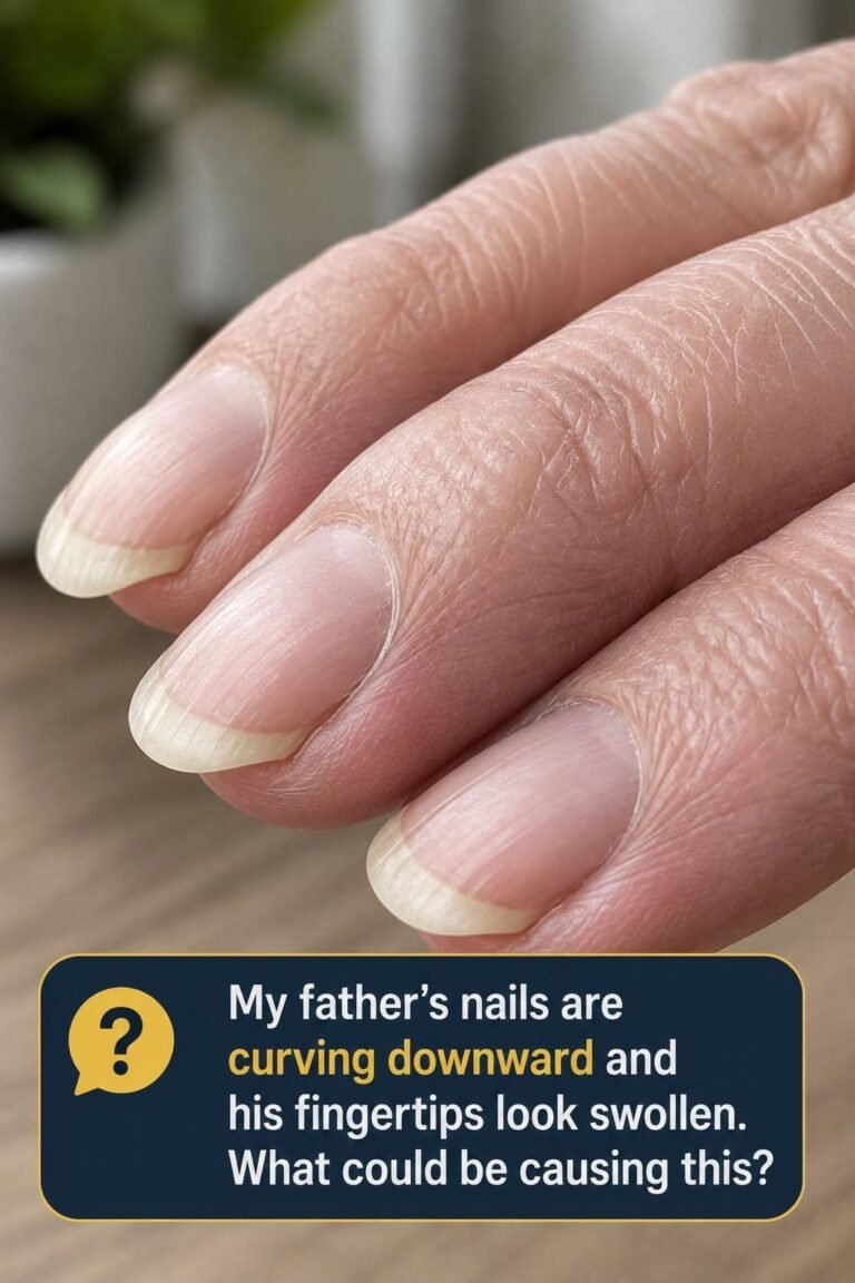 My dad’s fingertips have become really round and the nails are curving over the edge. Why is this happening to him?. Full article 👇 💬