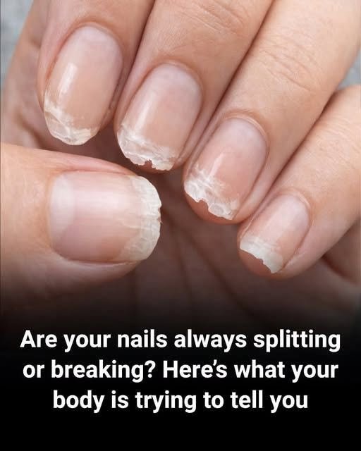 Brittle or Weak Nails? Your Body Might Be Trying to Tell You Something…